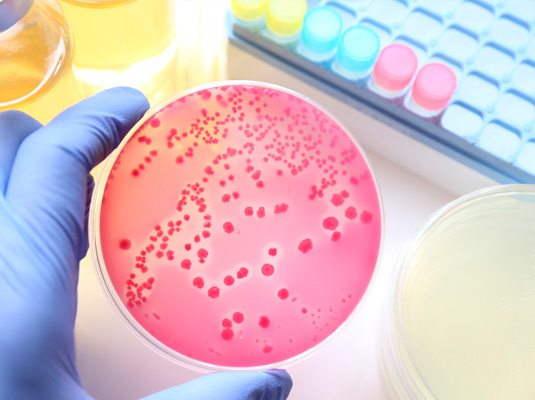 Microbiologicos banner-microbiologicos – Inocuolab